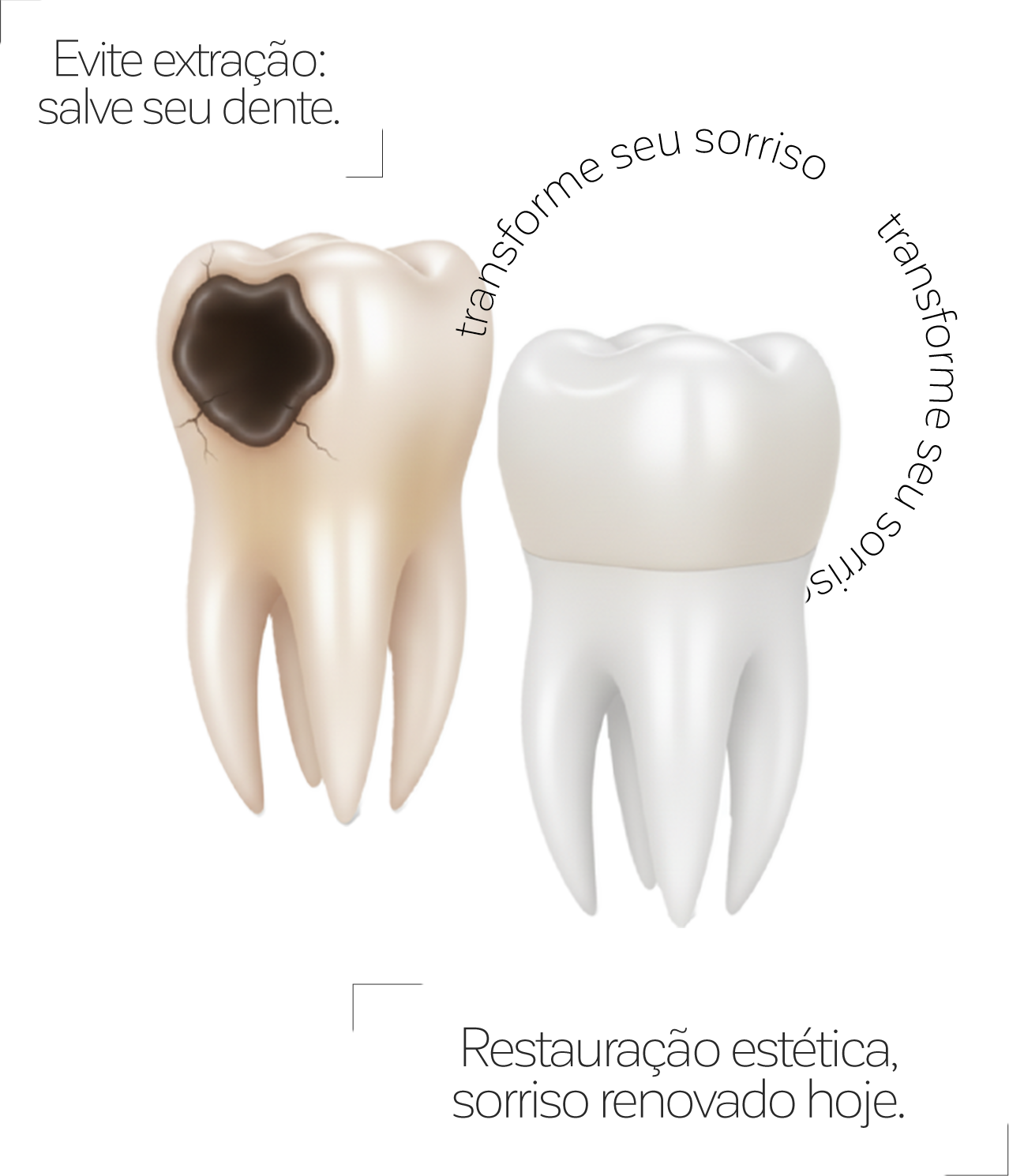 tratamento de canal ribeirão preto