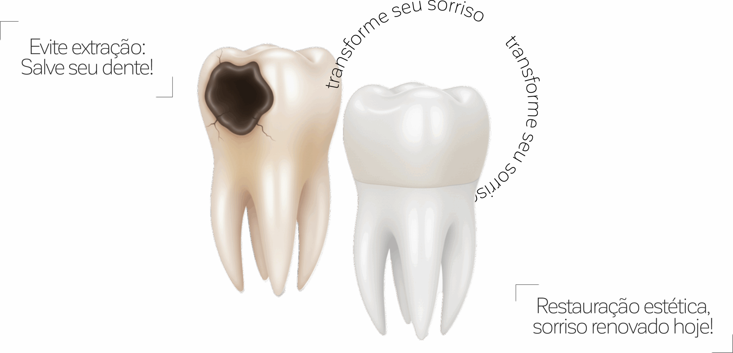 tratamento de canal ribeirão preto